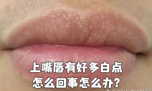 来月经可以接种宫颈癌疫苗吗-例假期间能否接种宫颈癌疫苗网 :分享例假期间能否接种宫颈癌疫苗第三针-月经期可以打宫颈疫苗针吗知识