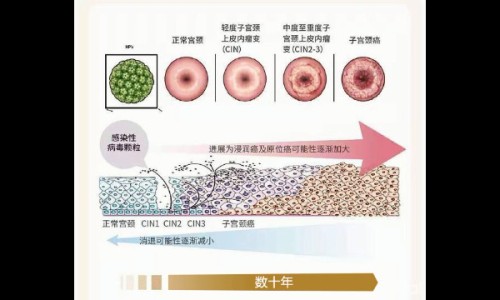 月经期宫颈癌疫苗接种可以打吗-例假期间能否接种宫颈癌疫苗网 :分享例假期间能否接种宫颈癌疫苗第三针-月经期可以打宫颈疫苗针吗知识